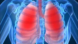 Бронхиальная астма: симптомы первая помощь