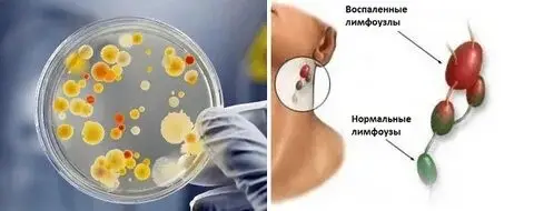 О дифтерии доступно.