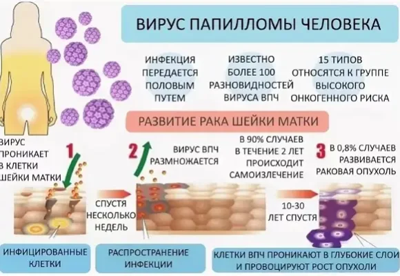 virus_papilomi_cheloveka_u_genchin Вакциная от ВПЧ для профилактики рака шейки матки