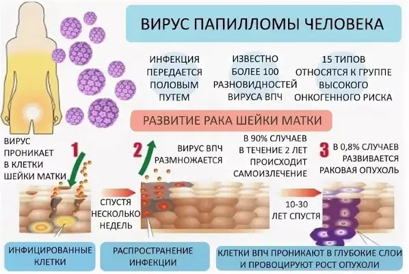 virus_papilomi_cheloveka_u_genchin Вакциная от ВПЧ для профилактики рака шейки матки