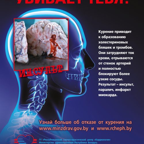 kagdaia sigareta ubivaet Республиканская информационно-образовательная акция «Беларусь против табака»