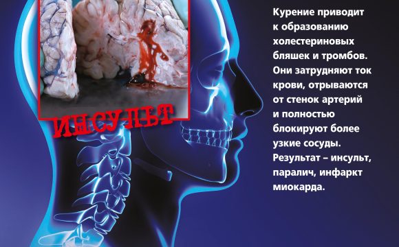 kagdaia sigareta ubivaet Республиканская информационно-образовательная акция «Беларусь против табака»