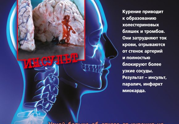 kagdaia sigareta ubivaet Республиканская информационно-образовательная акция «Беларусь против табака»