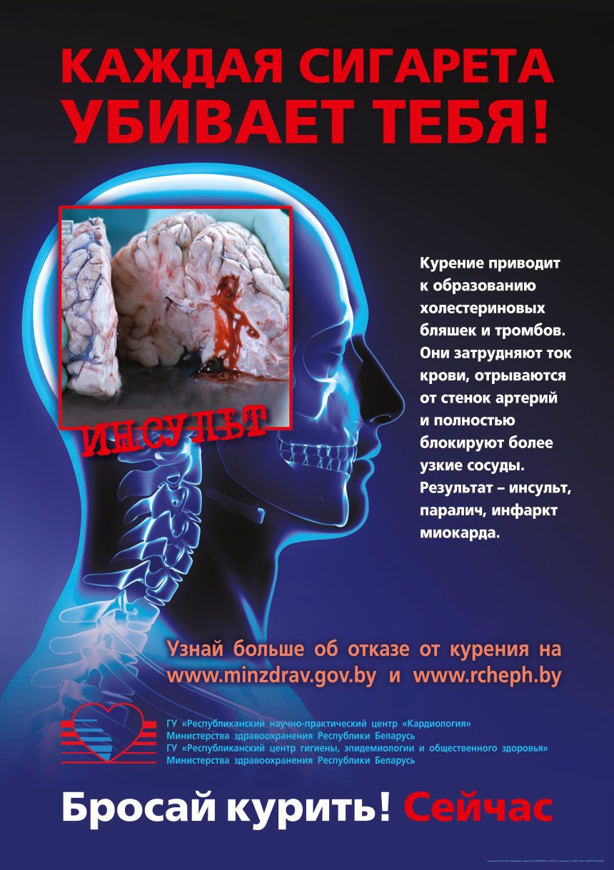 kagdaia sigareta ubivaet Республиканская информационно-образовательная акция «Беларусь против табака»