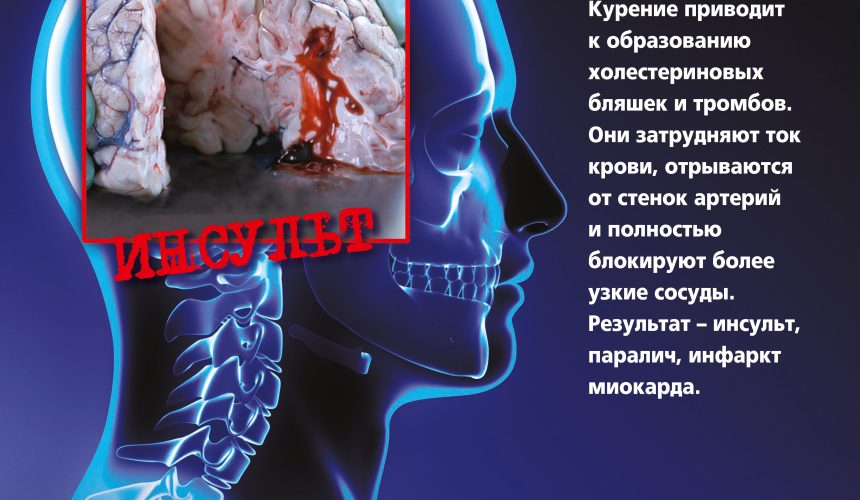 kagdaia sigareta ubivaet Республиканская информационно-образовательная акция «Беларусь против табака»